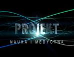 Graf. TVP Łódź