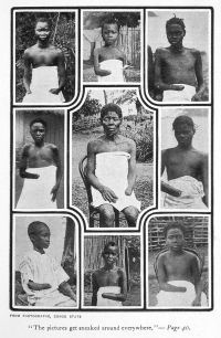 Jedną z najczęstszych kar stosowanych w Kongo za króla Leopolda II było ucięcie dłoni (Fot. Wikipedia)
