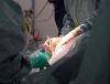 Specjaliści wszczepili hybrydowy implant ślimakowego i zniwelowali  otosklerozę (fot. flickr.com/salimfadhley)